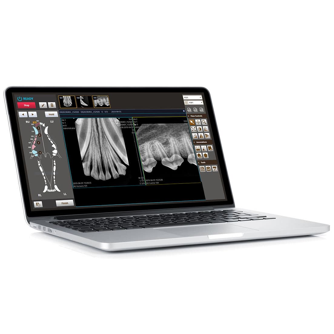 Software für dentale Bildgebung MyVet Dent™ my vet imaging für