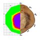 Resonanztomograph für Bäume