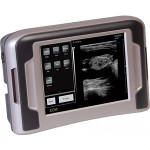 scanner à ultrason portable