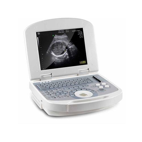 Échographe vétérinaire portable - V2200 - Sunway Medical - pour grands animaux