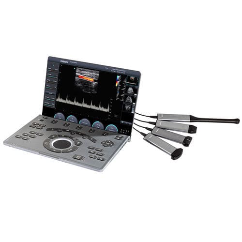 Échographe vétérinaire portable - SonoAir 30 - Chison Medical Imaging - pour grands animaux / pour animaux de la ferme / linéaire