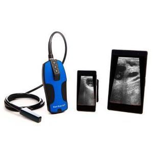 hand-held ultrasound scanner