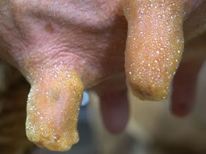 antibacterial teat cleaning solution / pre-milking
