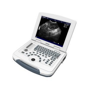 portable ultrasound scanner