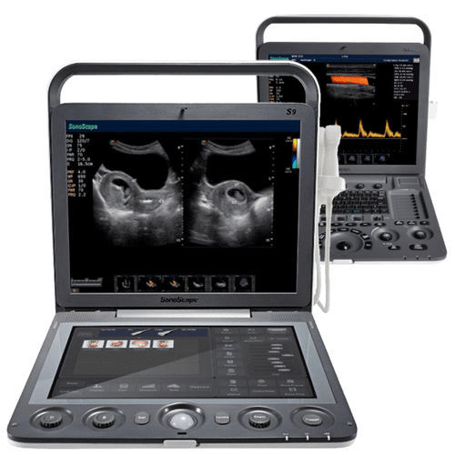 Portable veterinary ultrasound system Sonoscape SSeries universal
