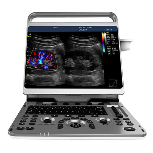 Ecógrafo veterinário móvel - EBit 50  - Chison Medical Imaging - para bovinos / para equídeos / para ovinos
