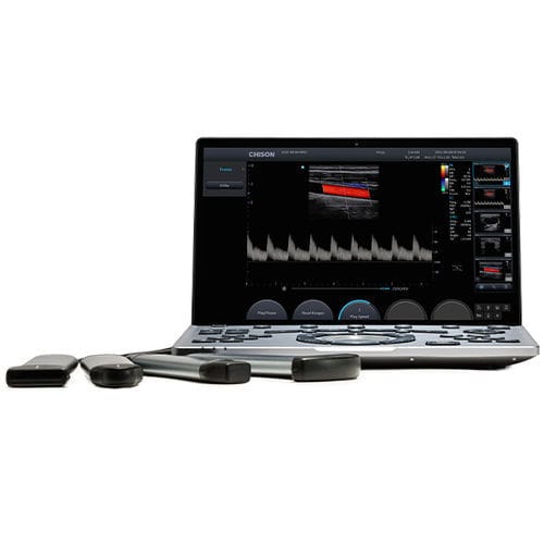 Ecógrafo veterinário portátil - SonoAir 60 - Chison Medical Imaging - para animais de grande porte / para animais de criação / linear